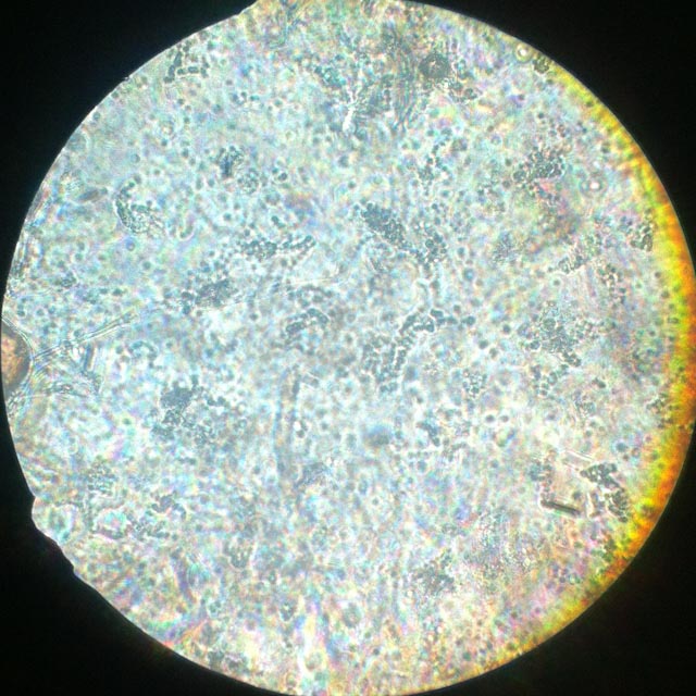 Identification de moisissures sous microscope